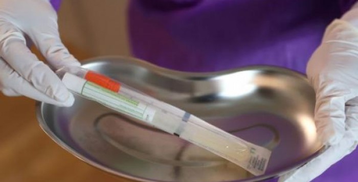 Αισιόδοξα μηνύματα από τον ΠΟΥ για τον κοροναϊό – Ξεκίνησαν οι πρώτες δοκιμές του εμβολίου