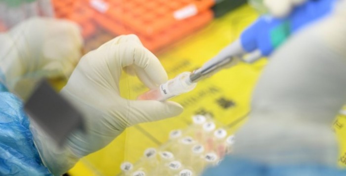 Tεστ ανιχνεύει τον κορονοϊό σε μόλις 5 λεπτά, χάρη στη γονιδιακή τεχνική CRISPR που πήρε Νόμπελ Χημείας
