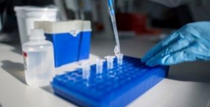 Γερμανία: Η κυβέρνηση παραγγέλνει φαρμακευτικά παρασκευάσματα κατά της ελονοσίας ως πιθανό θεραπευτικό μέσο κατά του κορονοϊού