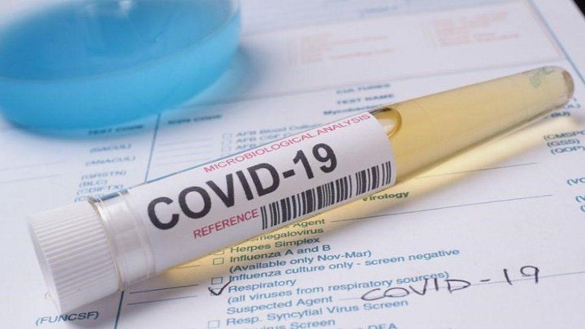 Έρευνα: Η Covid-19 μπορεί να προκαλέσει προσωρινές μειώσεις στο προσδόκιμο ζωής σε πολλές χώρες